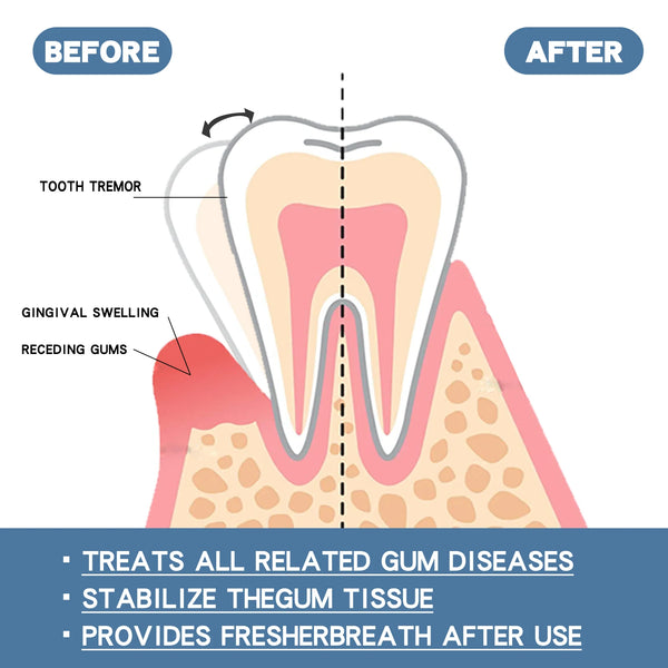 Gentle Smile Care Drops